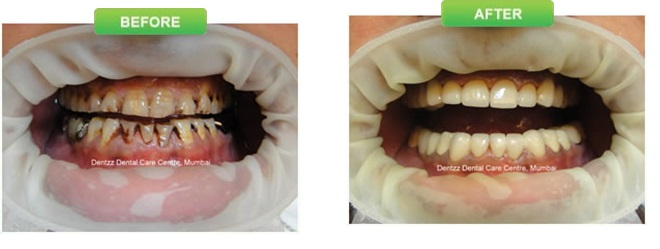 Proof That pediatric dental care Really Works